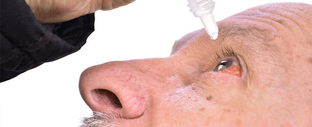 Conjuntivitis - VERTE Oftalmología Barcelona