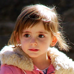 Glaucoma congénito infantil - VERTE Oftalmología Barcelona