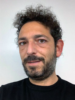 Paciente Cirugía ICL - Antón - VERTE Oftalmología Barcelona