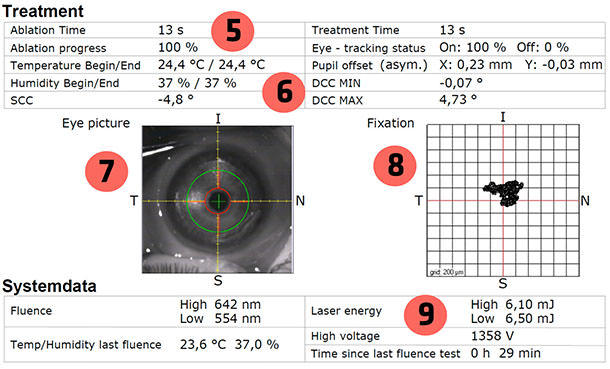 Cirugía Laser - Laser Amaris - Astigmatismo y Miopía - VERTE Oftalmología Barcelona