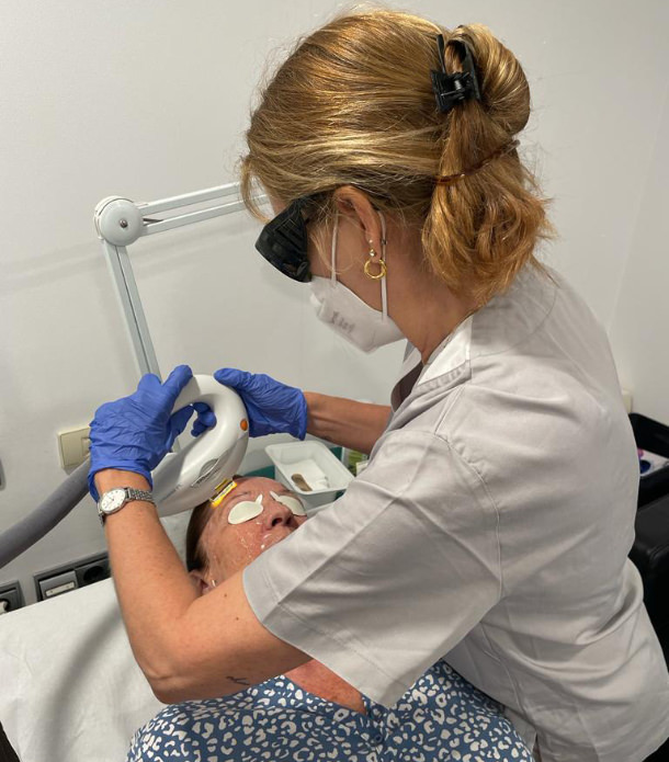 Rejuvenecimiento de la mirada - IPL - VERTE Oftalmología Barcelona