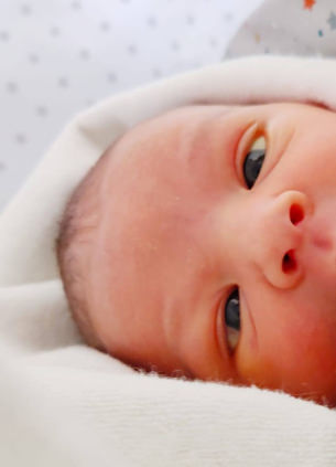 Estrabismo bebé - VERTE Oftalmología Barcelona