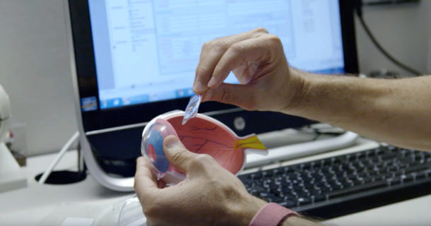 Lentes ICL - Ubicación - VERTE Oftalmología Barcelona