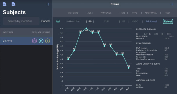 Curva de desenfoque - Lentes Trifocales - VERTE Oftalmología Barcelona