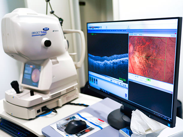 OCT Retina - VERTE Oftalmología Barcelona