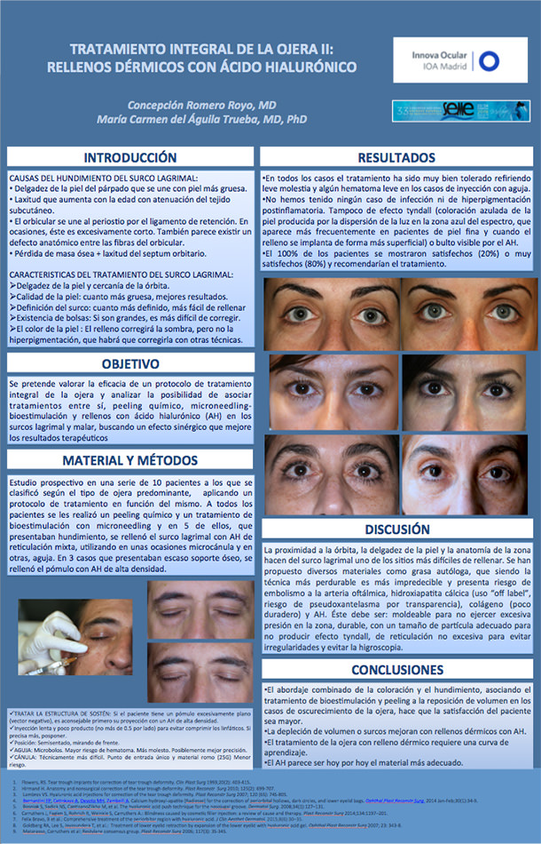 Poster Dra. Romero - IOA Madrid - SEME 2018