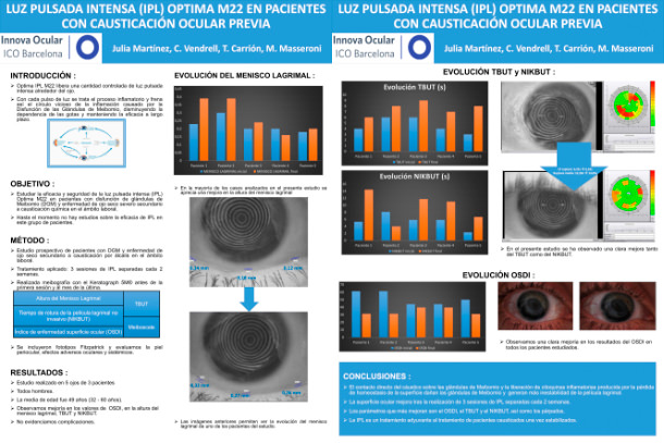 Premi SCOFT - Mejor pòster - IPL - VERTE Oftalmología Barcelona