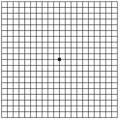 ¿Cada cuándo tengo que mirar la rejilla de Amsler? - VERTE Oftalmología Barcelona