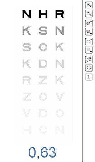Sensibilidad al Contraste - VERTE Oftalmología Barcelona