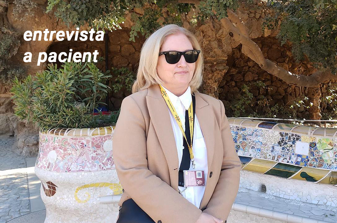 Mussols i blefaritis - IPL - VERTE Oftalmologia Barcelona