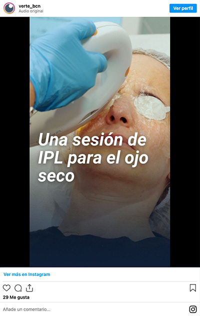 IPL- Ojo seco - VERTE Oftalmologia Barcelona