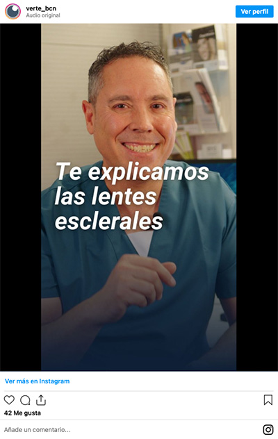 Lentes Esclerales - VERTE Oftalmologia Barcelona