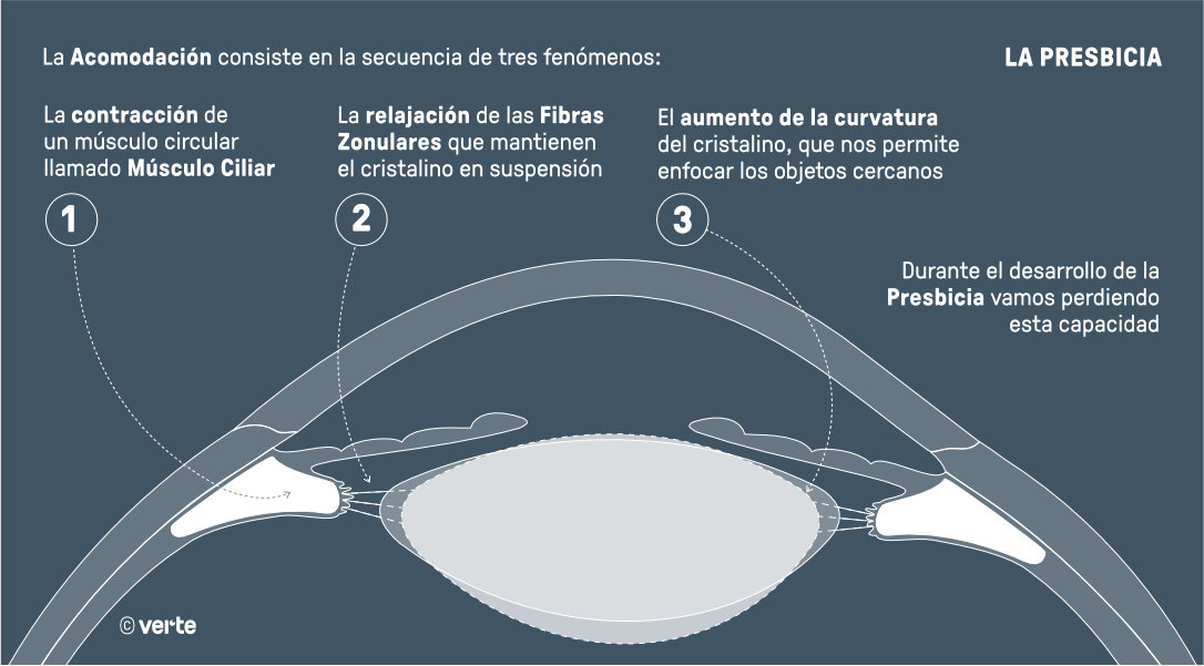 Presbicia - VIsta cansada - VERTE Oftalmología Barcelona